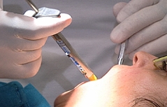 Zahnarzt Arzt Injektion Injektionsnadel Spritze Narkose Betäubung