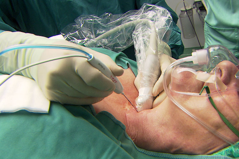 Schilddrüsenbehandlung nach neuer Methode im Uniklinikum Salzburg